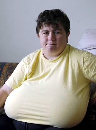 Big breasts make me suicidal, says 40HH woman