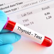 A generic photo of a thyroid function blood test. See PA Feature HEALTH Thyroid. Picture credit should read: Thinkstock/PA. WARNING: This picture must only be used to accompany PA Feature HEALTH Thyroid..