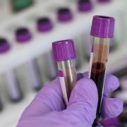 Dr Zak answers reader questions on blood tests