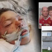 Blaine Beattie,10, has been left in hospital and homeless with dad Paul, inset, after their Peterlee home was subject to a suspected arson attack.