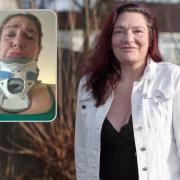 Annabel Arger, 44, who was left her in a five-day coma when a chimney fell off a roof and landed on her face