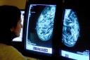 Last year, a poll of all 60 directors of the UK's cancer centres by the Royal College of Radiologists (RCR) found 95% felt staff shortages were leading to longer waiting times for appointments and delays in cancer treatment