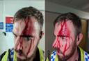 Shocking images of injuries police officer sustained in attack as man arrested