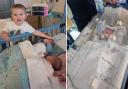 Baby Edward receiving care at the Royal Victoria Infirmary in Newcastle.