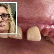 A woman has suffered a four-year long ordeal after not being given adequate dental care