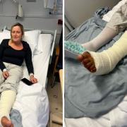 Kirstie Sandford in York Hospital after she was attacked by a dog
