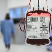 The NHS is calling for more under-35s to give blood